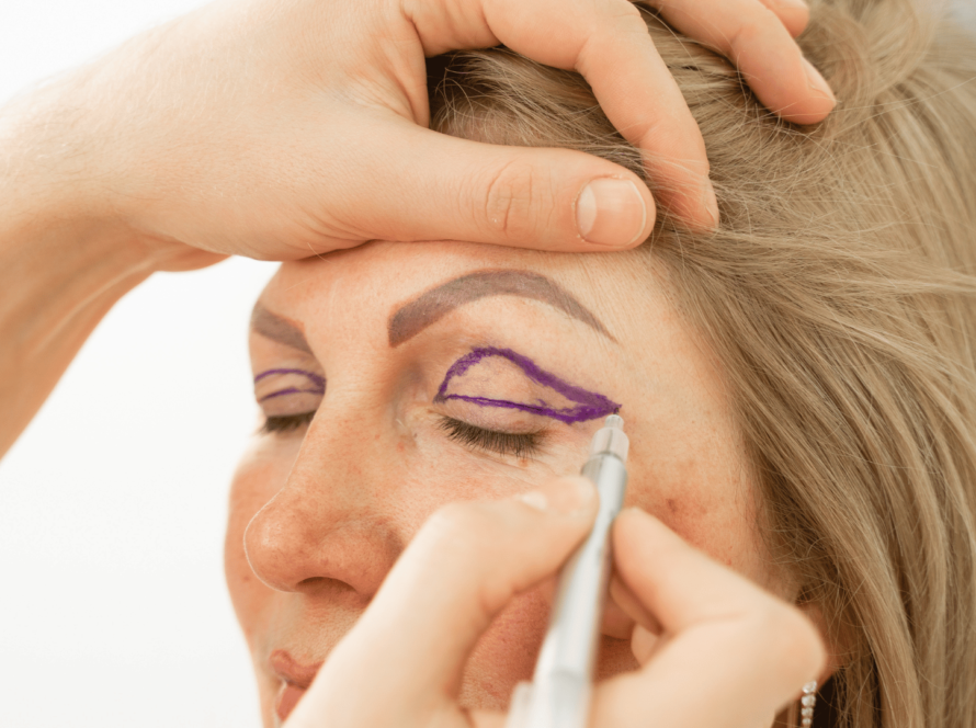 cost of eyelid blepharoplasty