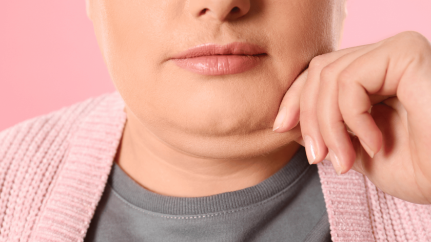 double chin liposuction cost