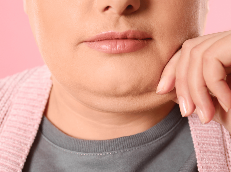 double chin liposuction cost