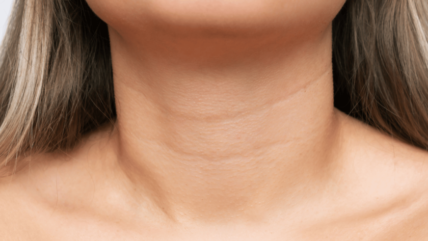 neck liposuction